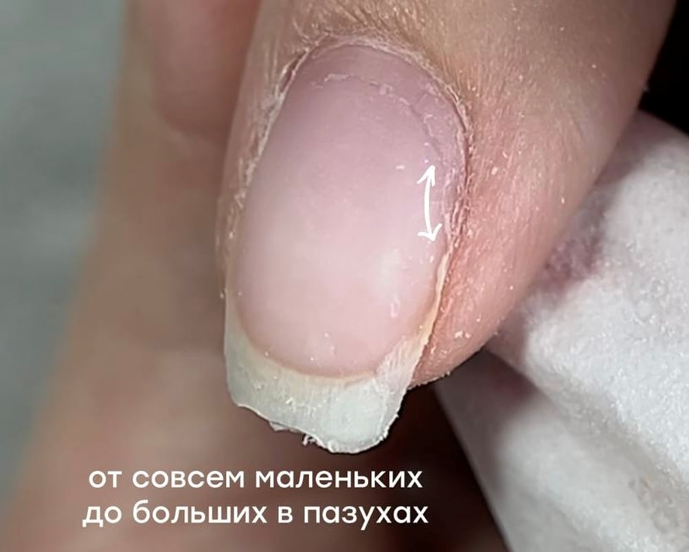Небанальные причины отслоек, о которых вы могли не знать